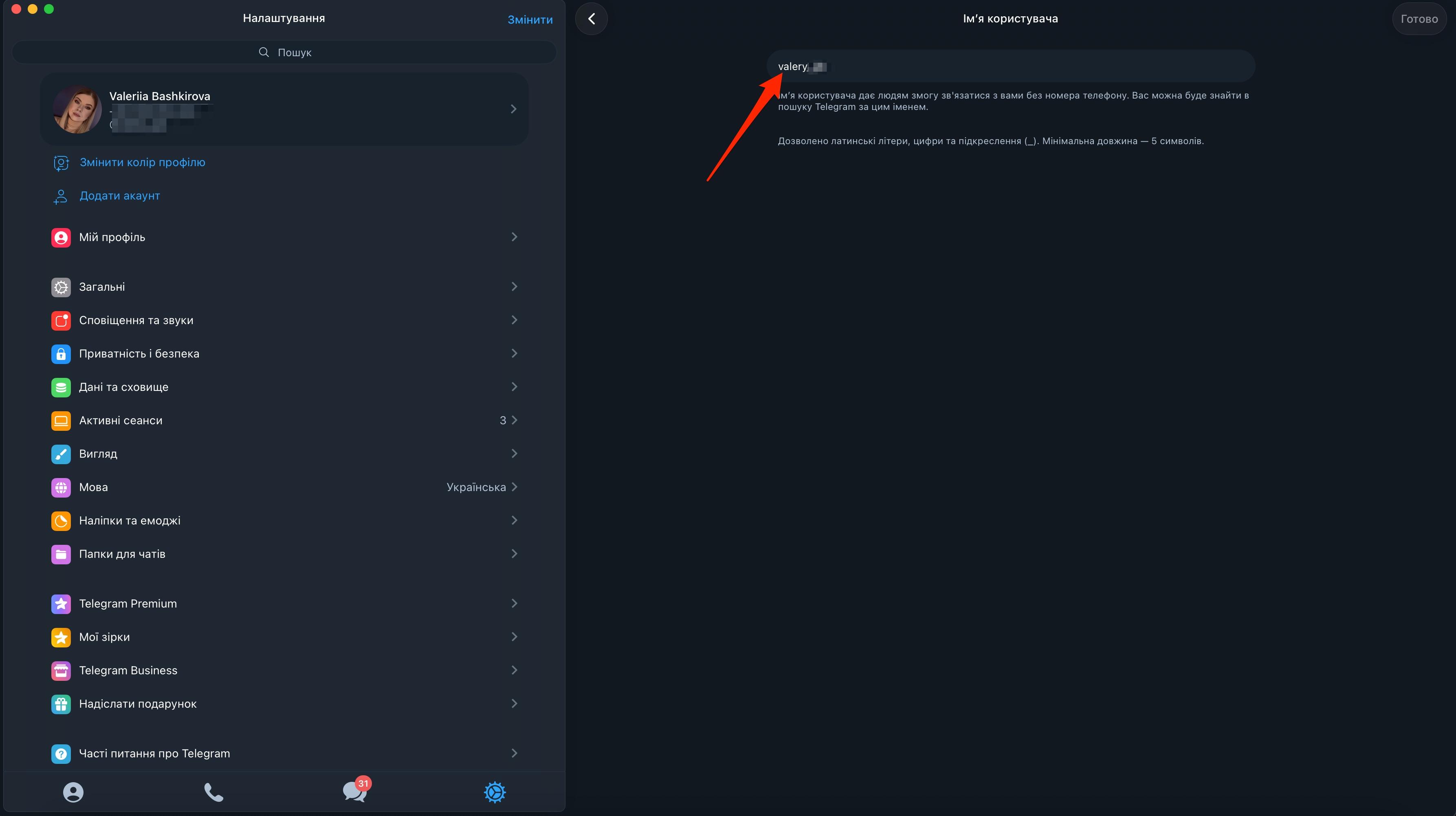 channel options in widget15.jpg
